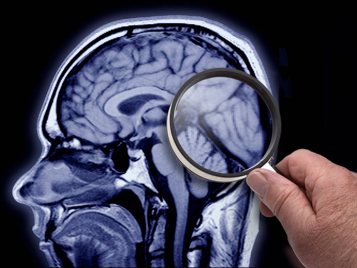 Врачи опробовали на 25-летнем пациенте новую методику перезагрузки мозга