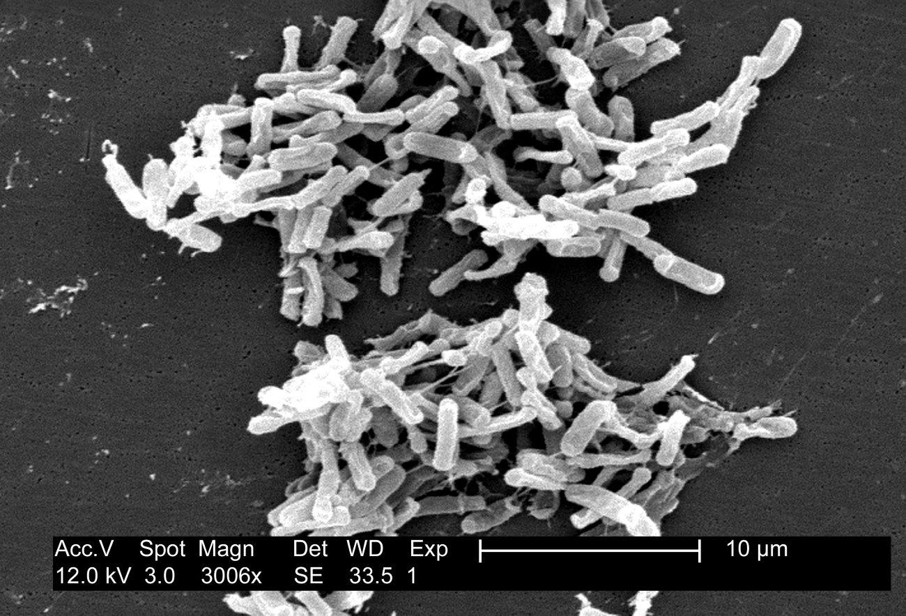 Древние микроорганизмы показали, что жизнь появилась в гидротермальной среде