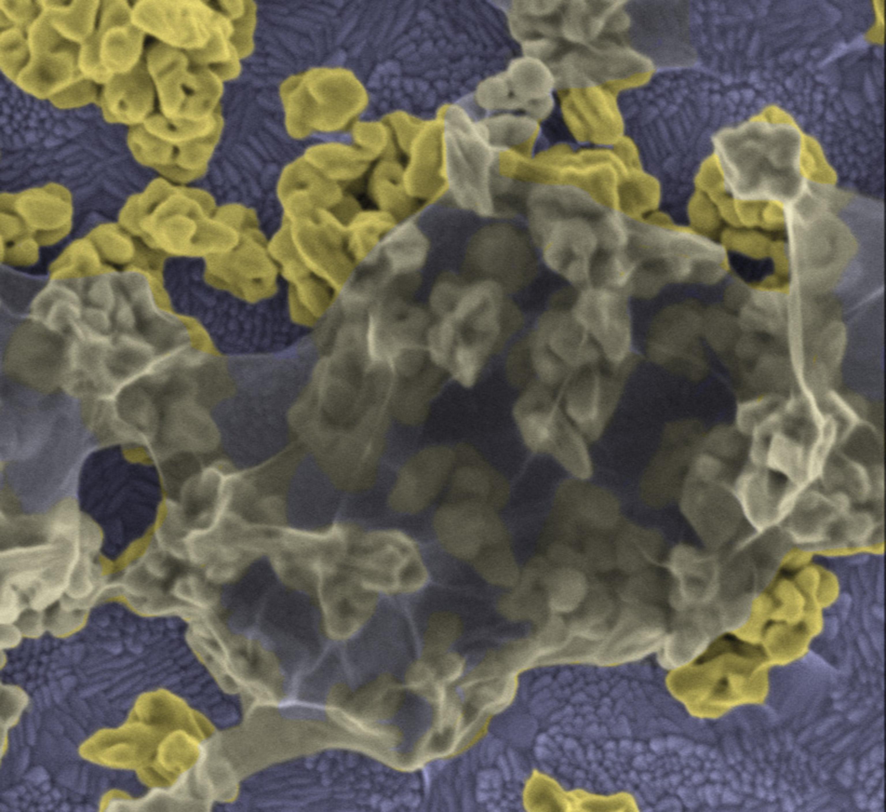 Золотые наночастицы помогут бороться с раком