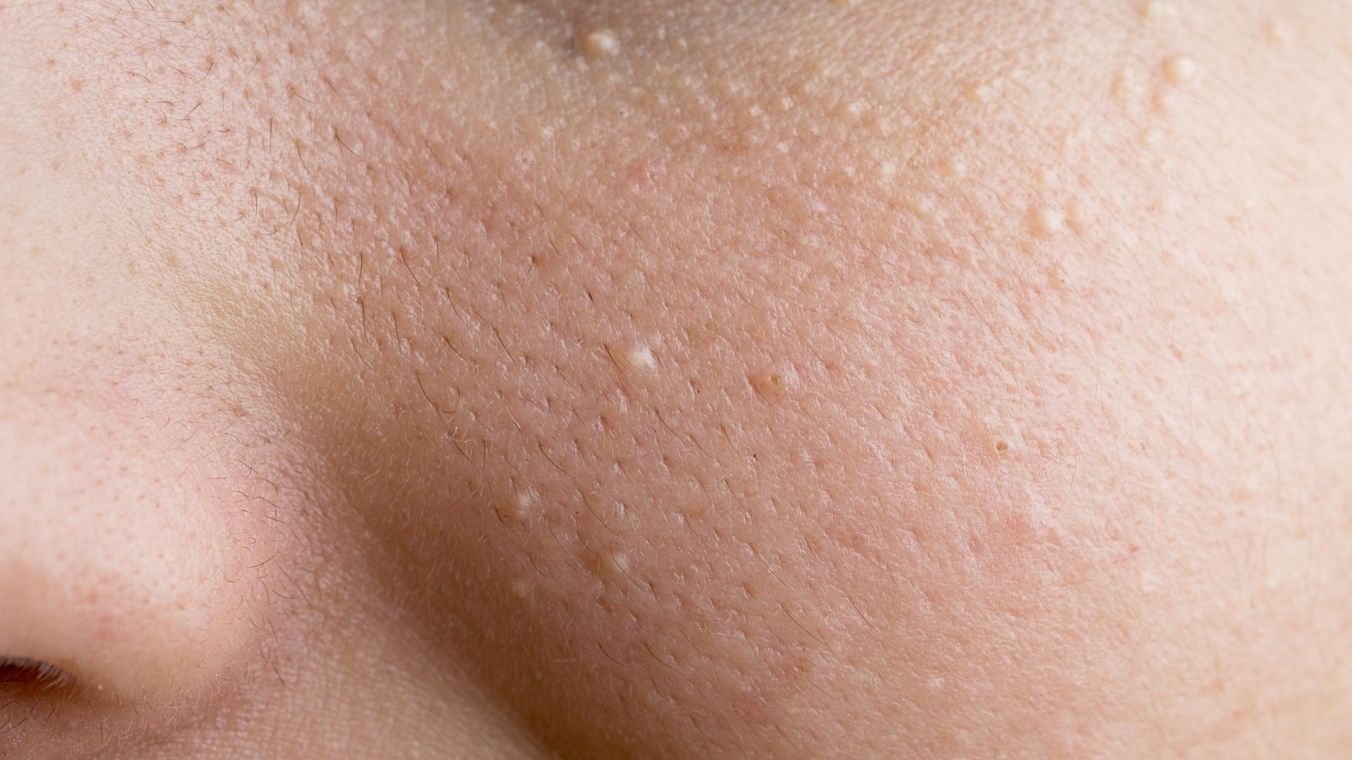Обонятельные рецепторы кожи участвуют в её заживлении
