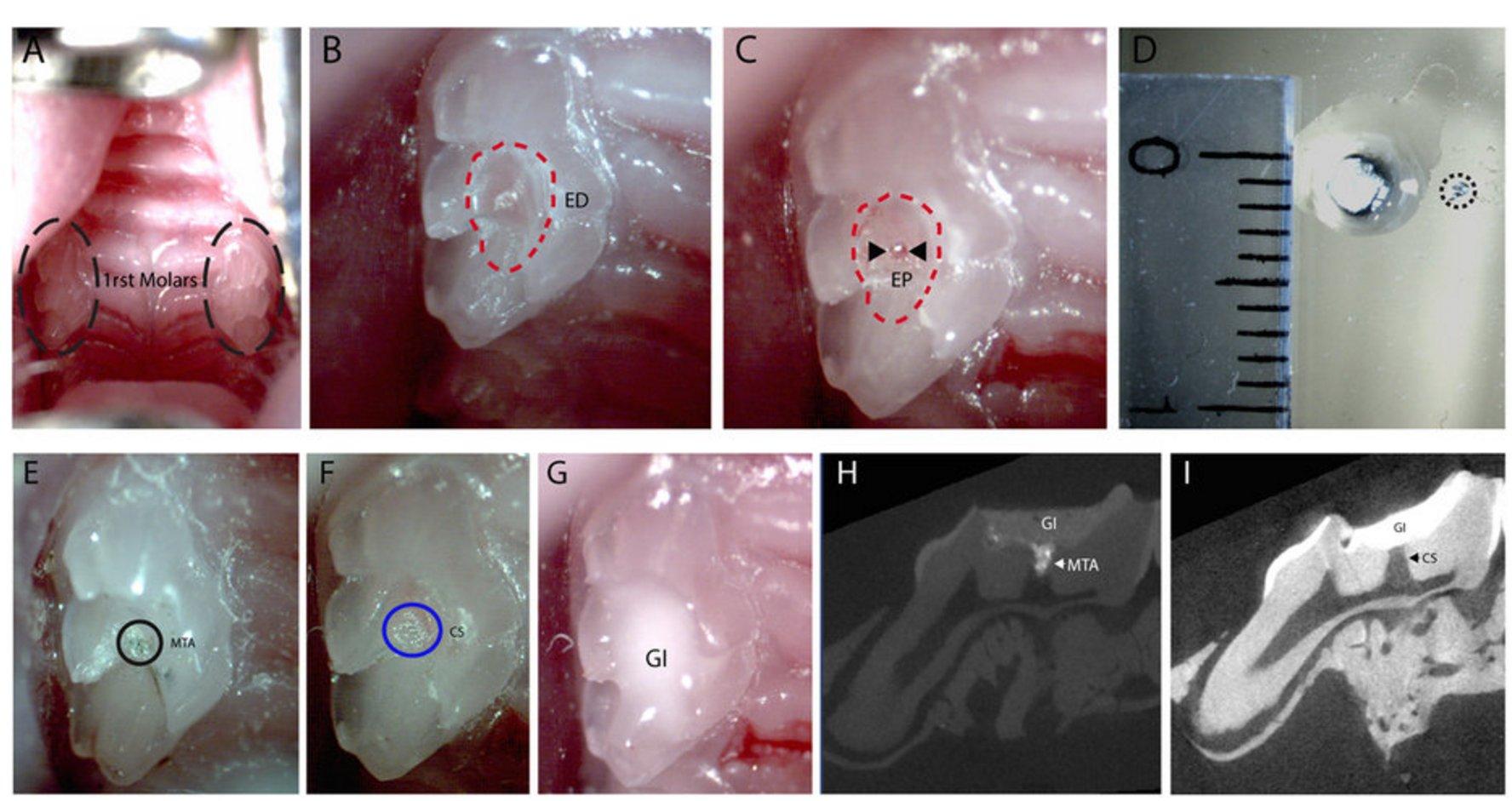 Учёные научились регенерировать повреждённые ткани зубов