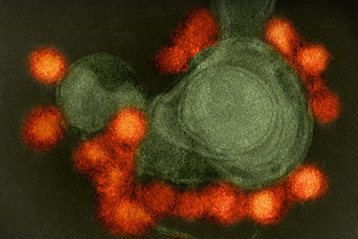 Медики определили белки, делающие вирус Зика опасным