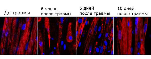 Разрушение и последующее восстановление биоинженерных мышечных волокон В лаборатории вырастили самовосстанавливающиеся мышцы