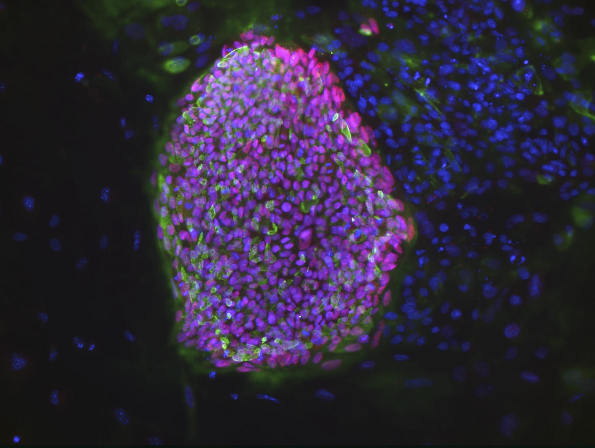 Клонирование человека привело к созданию новых стволовых клеток