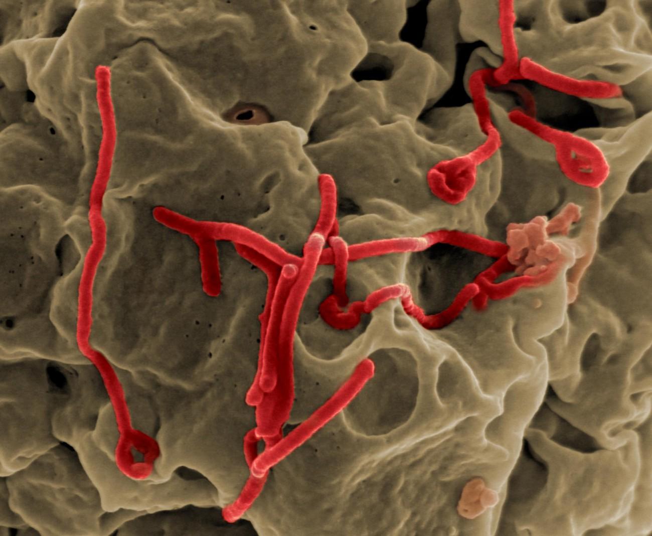 Секреты вируса Эбола