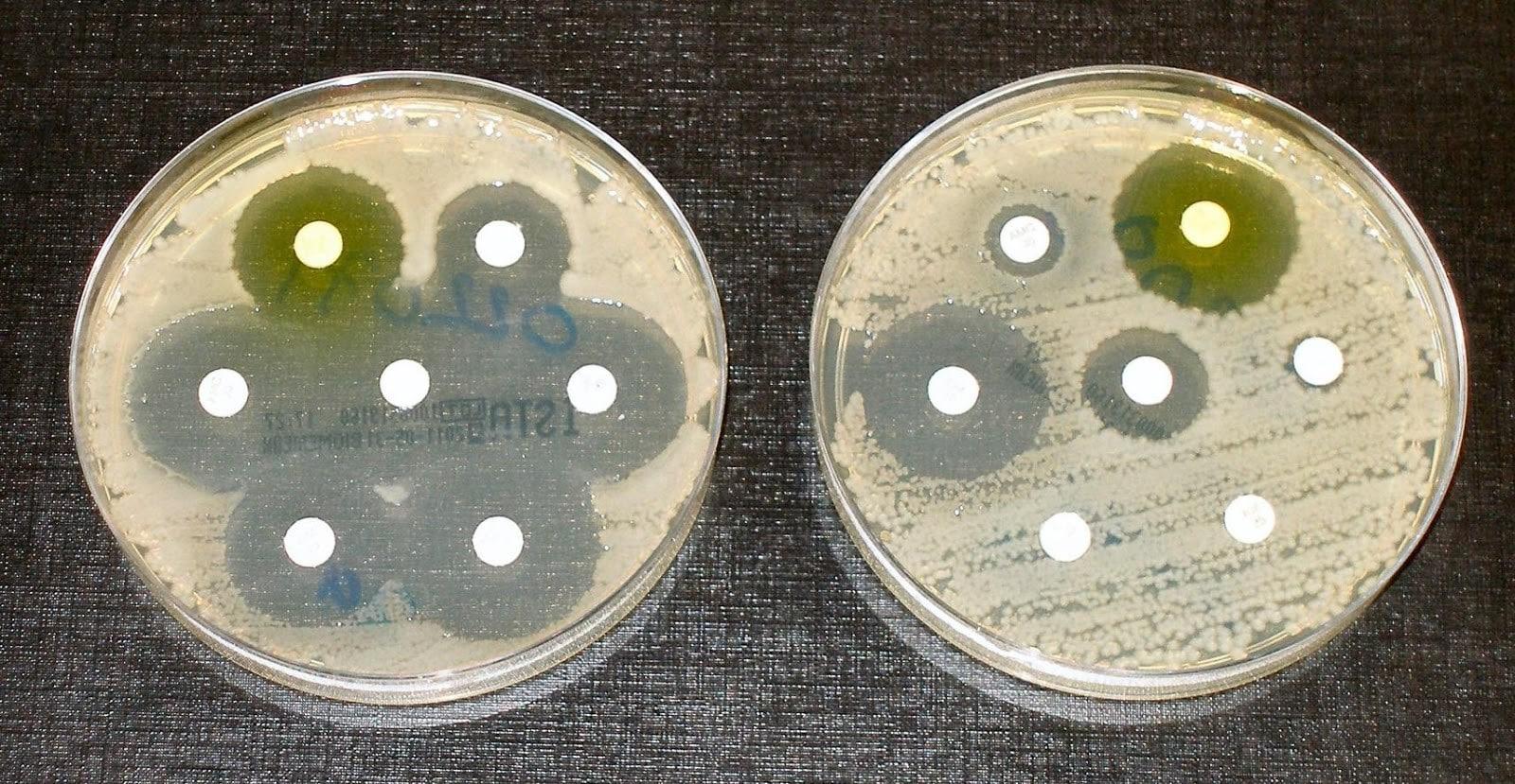 Бактерии выработали устойчивость к антибиотикам задолго до их открытия