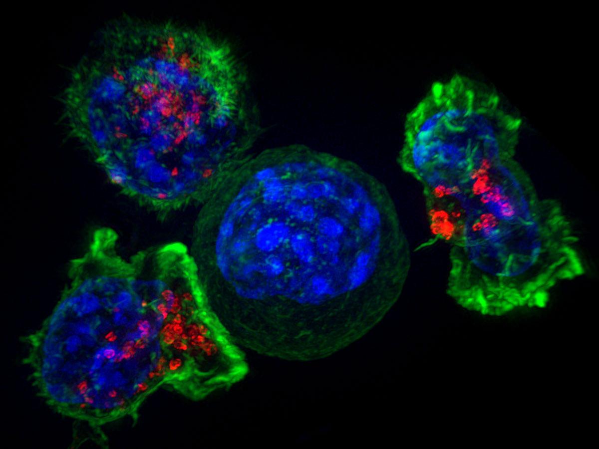 Иммунитет нападает на раковые клетки из засады