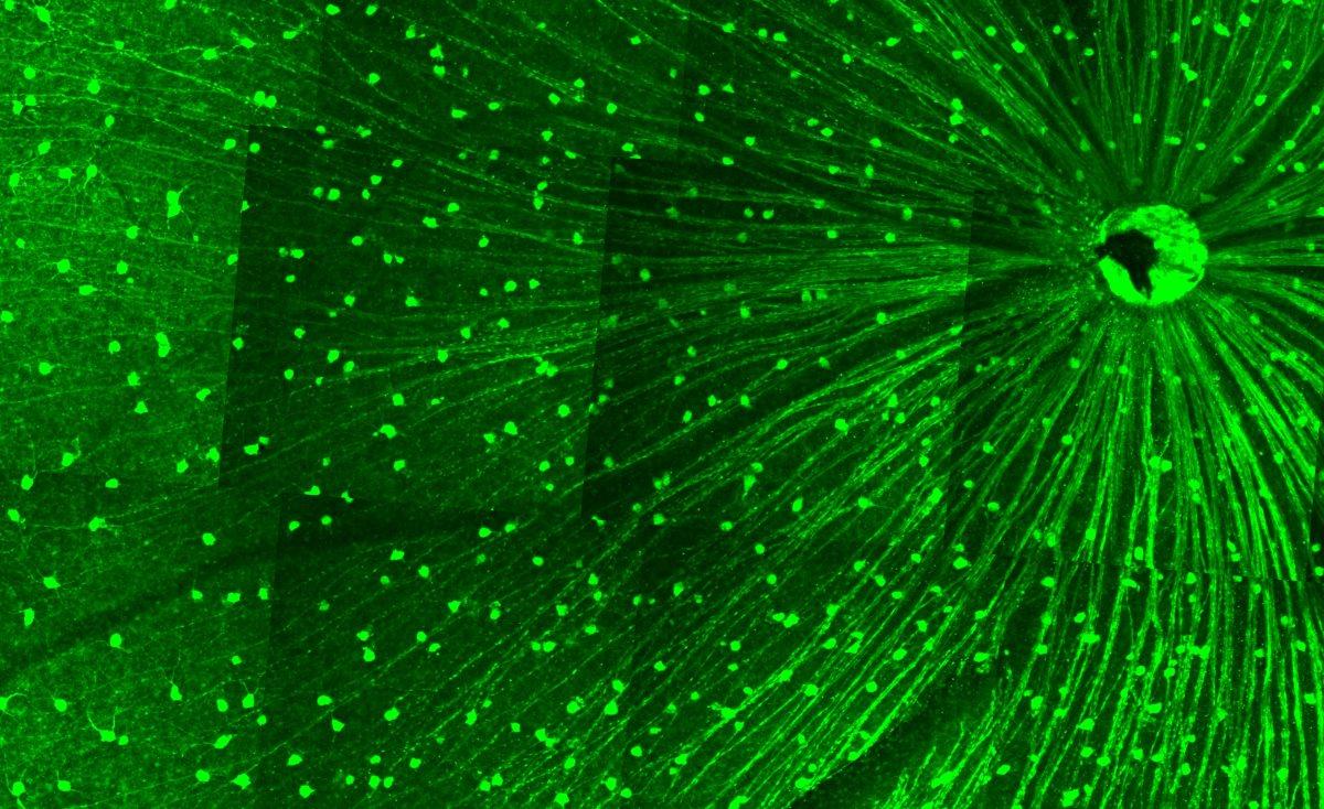 Регенерация нейронов сетчатки: «одно лечим, другое калечим»