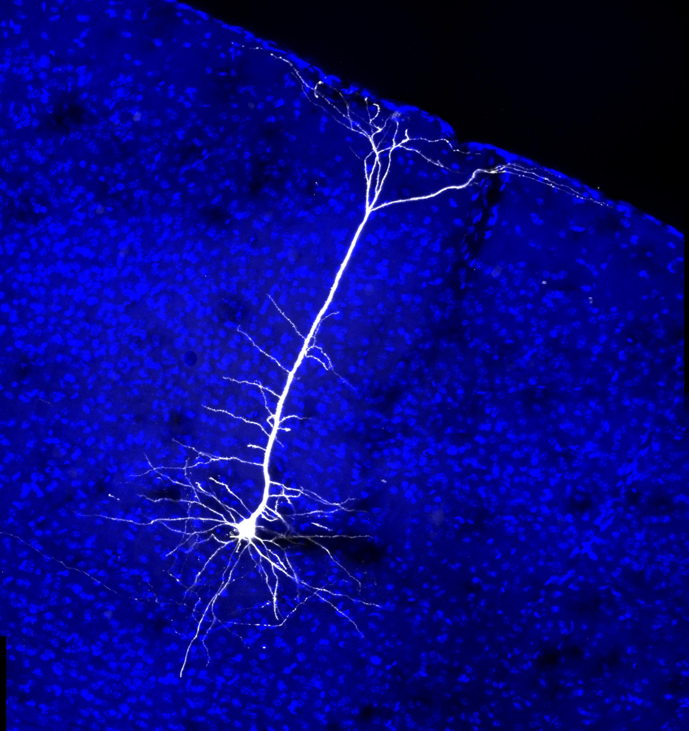 Человеческие нейроны прижились в мышином мозге