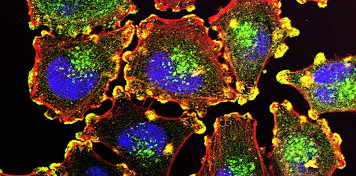 Короткие пептиды и РНК начали побеждать в борьбе иммунитета с раком
