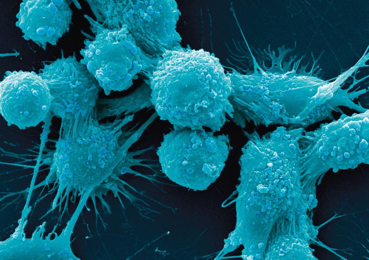 Сколько мутаций в раковой опухоли