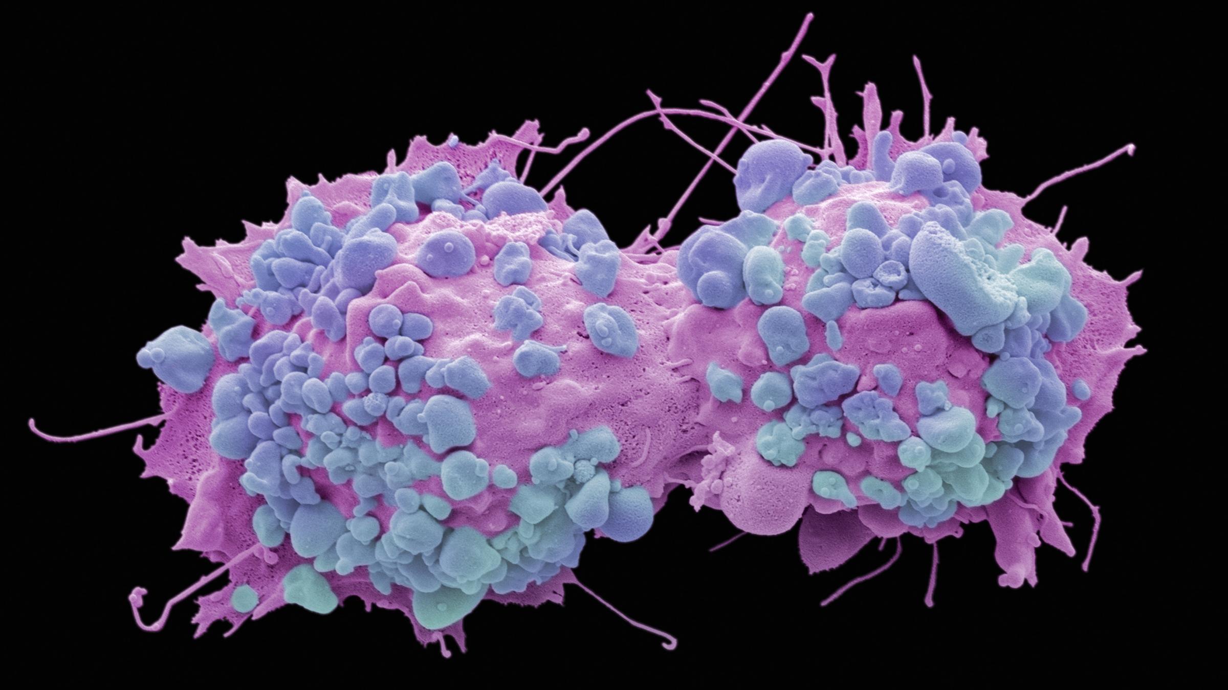 Раковые клетки умирают от быстрого деления
