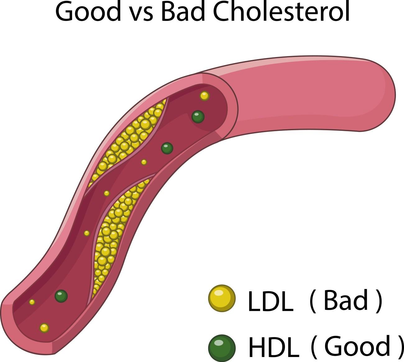Хороший, плохой, злой: что мы знаем о холестерине