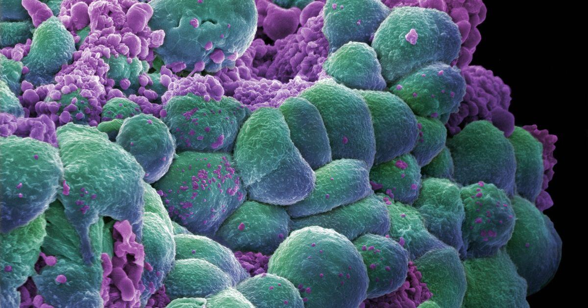 Биоразлагаемые наночастицы помогут в борьбе с раком