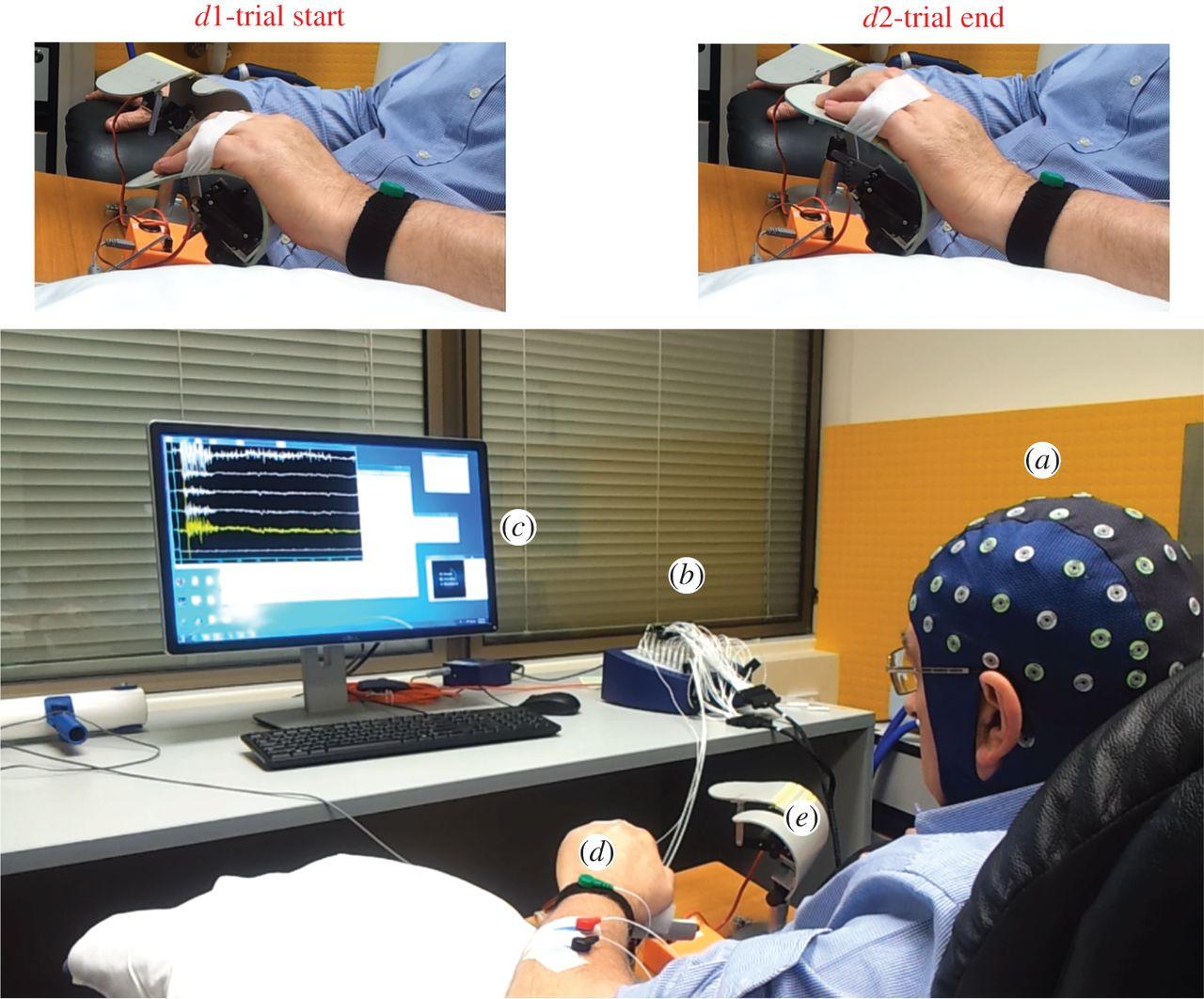 ЭЭГ-нейроинтерфейс помог справиться с последствиями инсульта