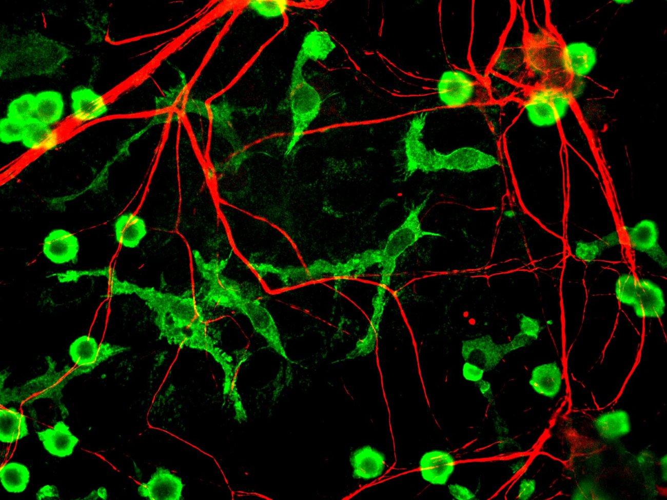 Болезнь Паркинсона остановили в мышах и человеческих нейронах