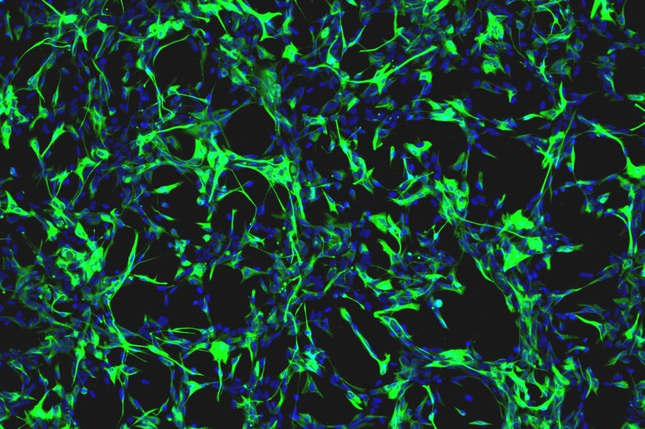 Астроциты «строят» новые синапсы с помощью своих белков