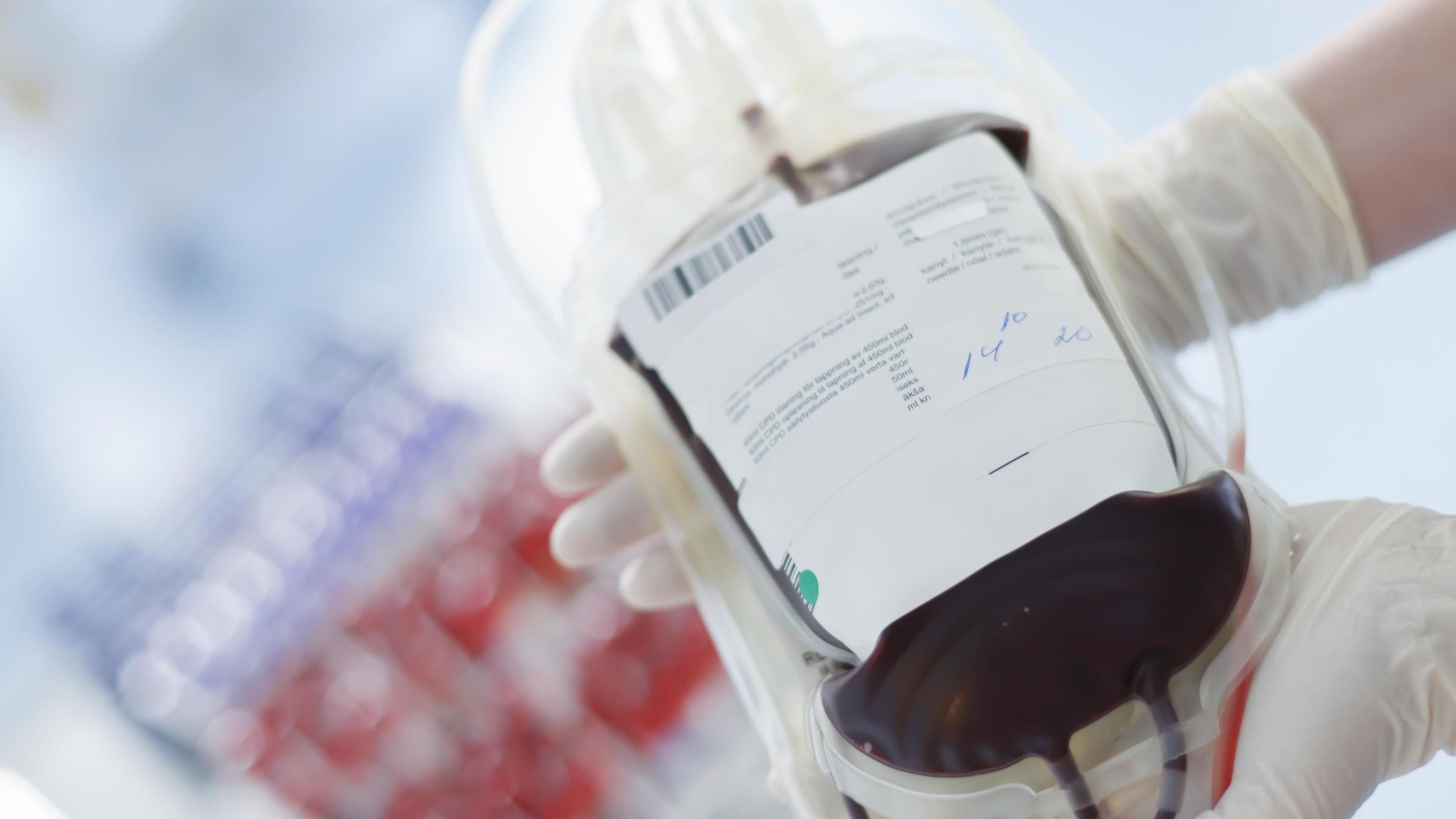 Переливание крови от беременной женщины может убить мужчину