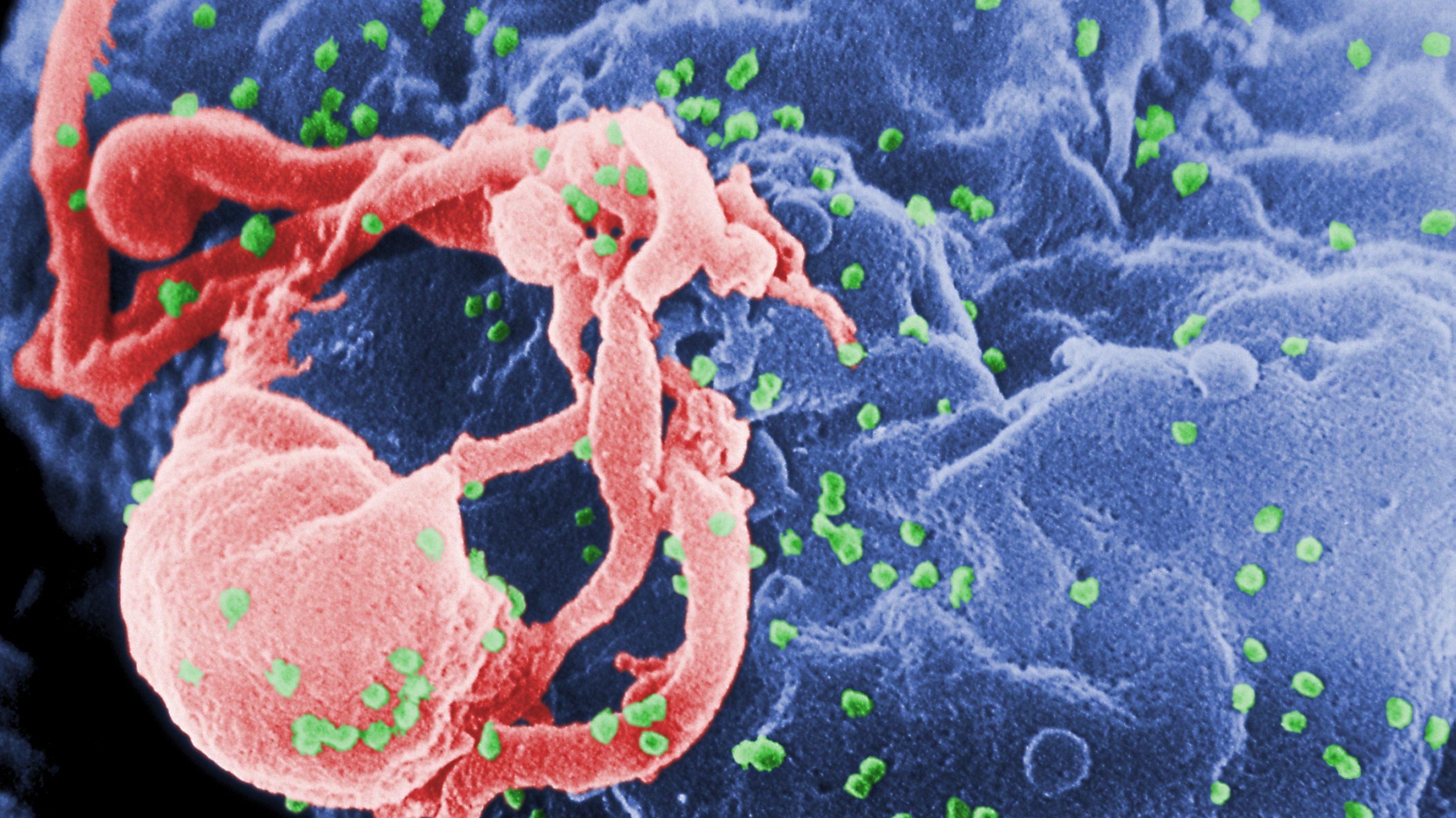Систему СRISPR/Cas впервые испытают внутривенно для лечения ВИЧ-инфекции у людей