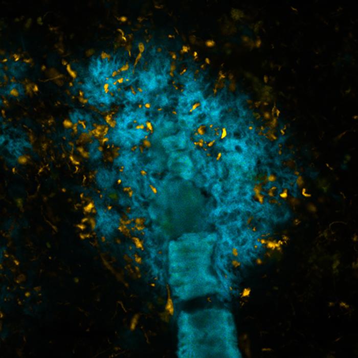 Светящиеся молекулы выведут болезнь Альцгеймера «из тени»