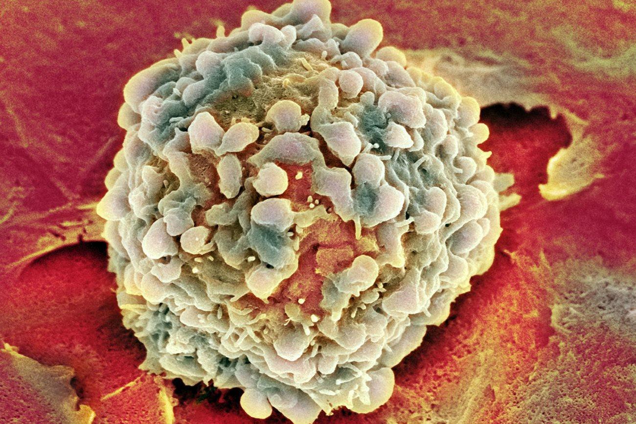 Как раковые клетки освобождают себе место