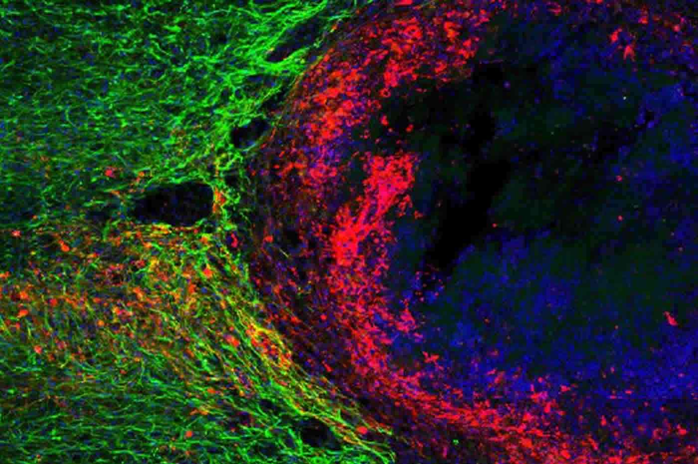 Глиальные «шрамы» помогают нейронам расти