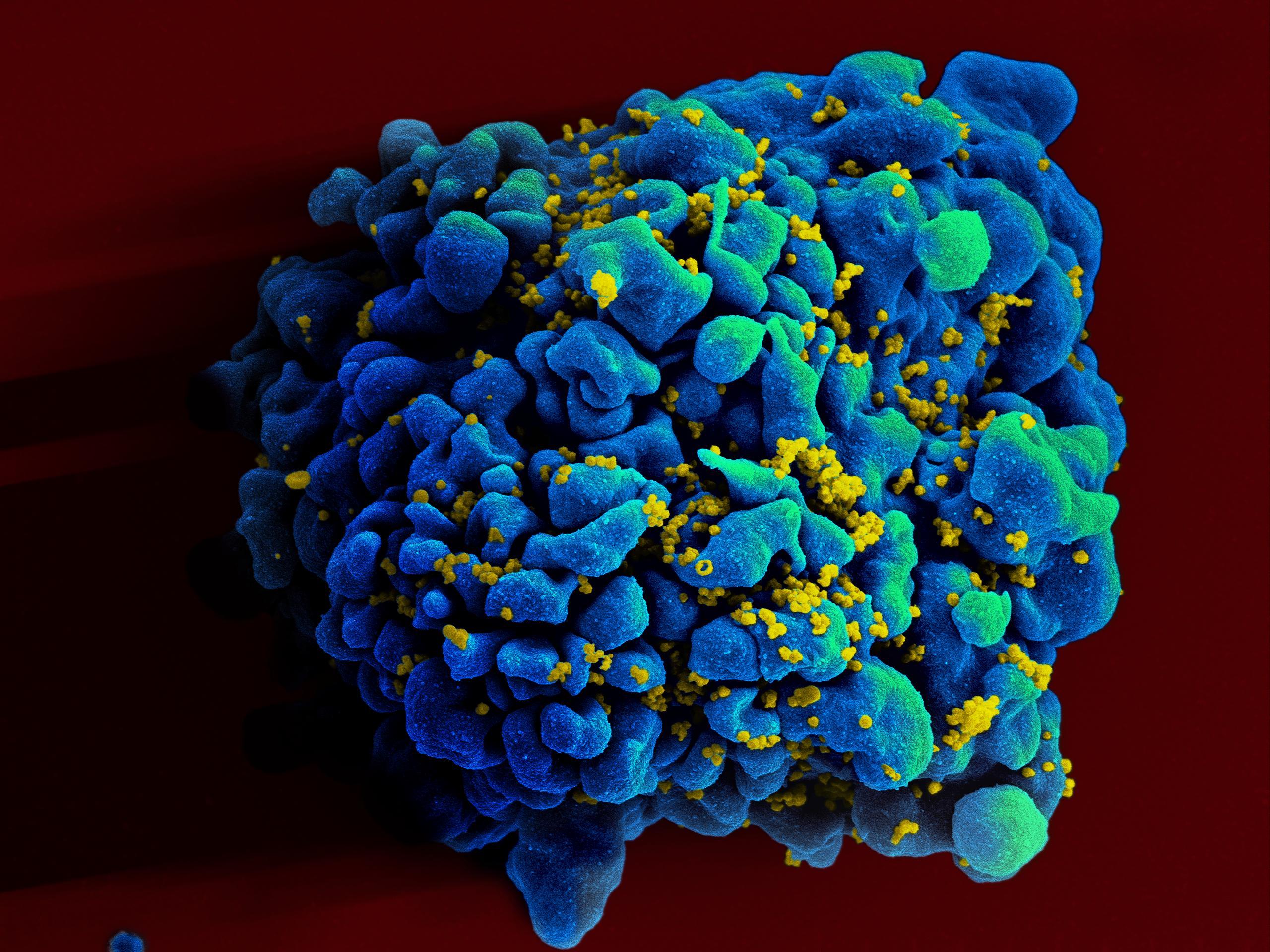 Уникальное «три-в-одном» антитело может бороться с 99% штаммов ВИЧ