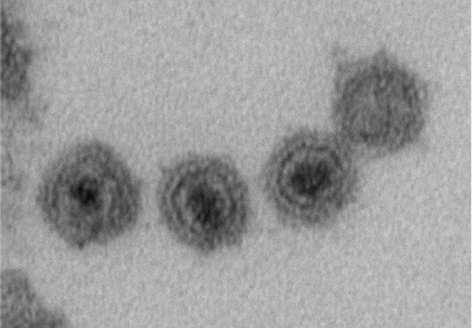 В Мировом океане нашли новые вирусы В Мировом океане нашли новые вирусы