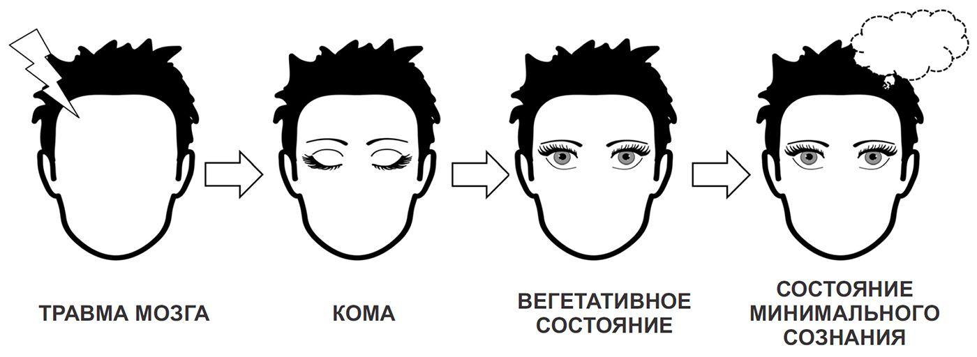 Минимальное состояние. Вегетативная состояние мозга. Хроническое вегетативное состояние. Персистирующее вегетативное состояние. Кома вегетативного статуса.