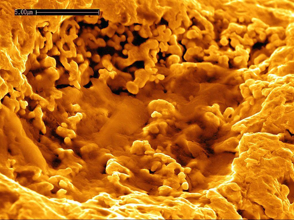 Странная бактерия «переваривает» токсичные металлы в золотые «самородки»