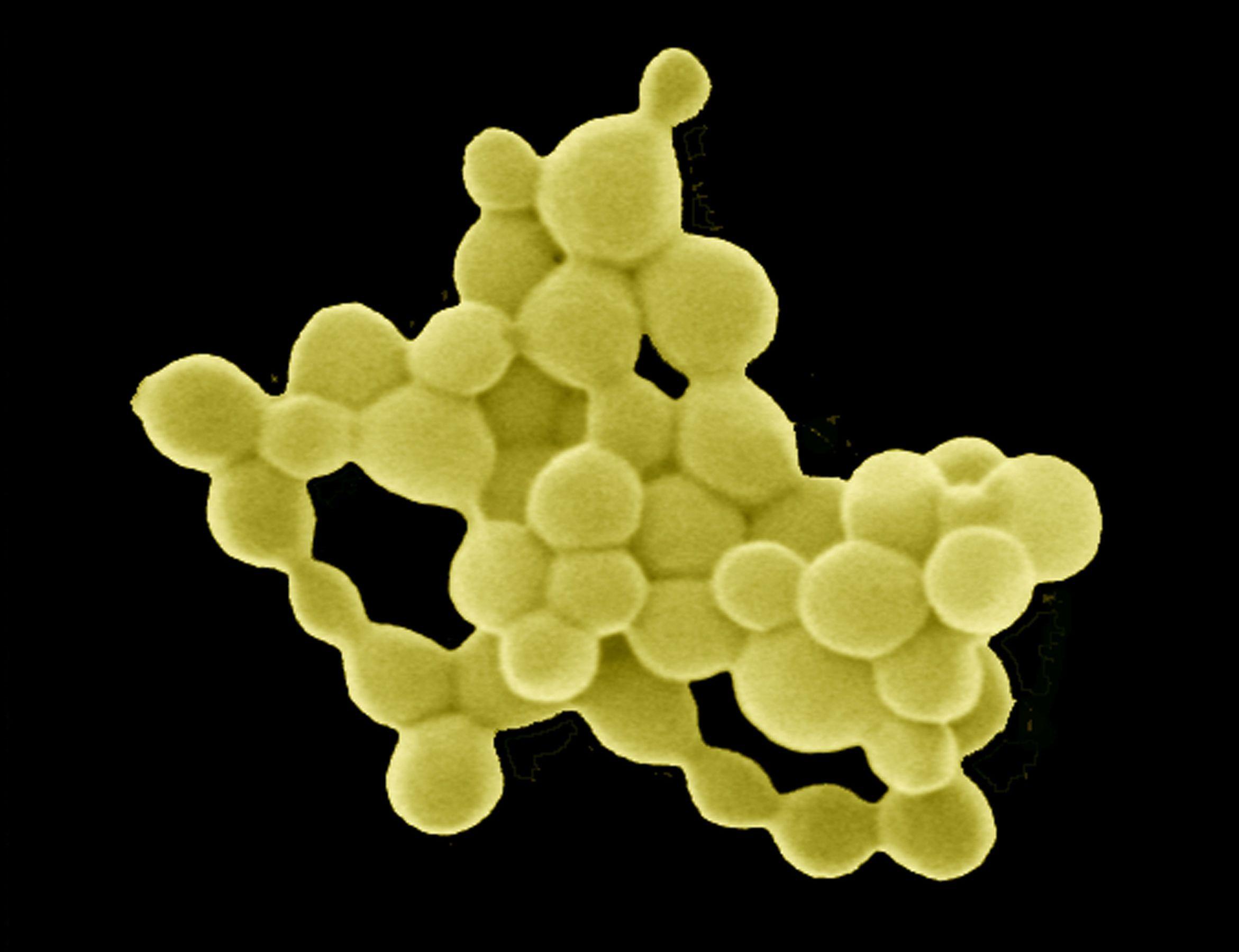 Странная бактерия «переваривает» токсичные металлы в золотые «самородки»