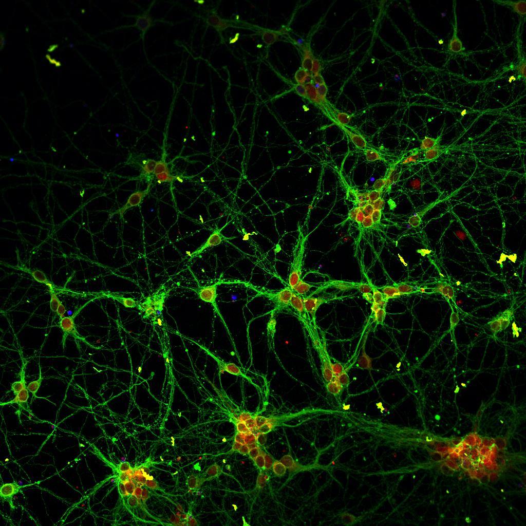 Новые нейроны перестают появляться в человеческом мозге после 13 лет