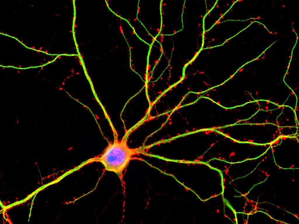 Болезнь Альцгеймера не даёт нейронам общаться друг с другом