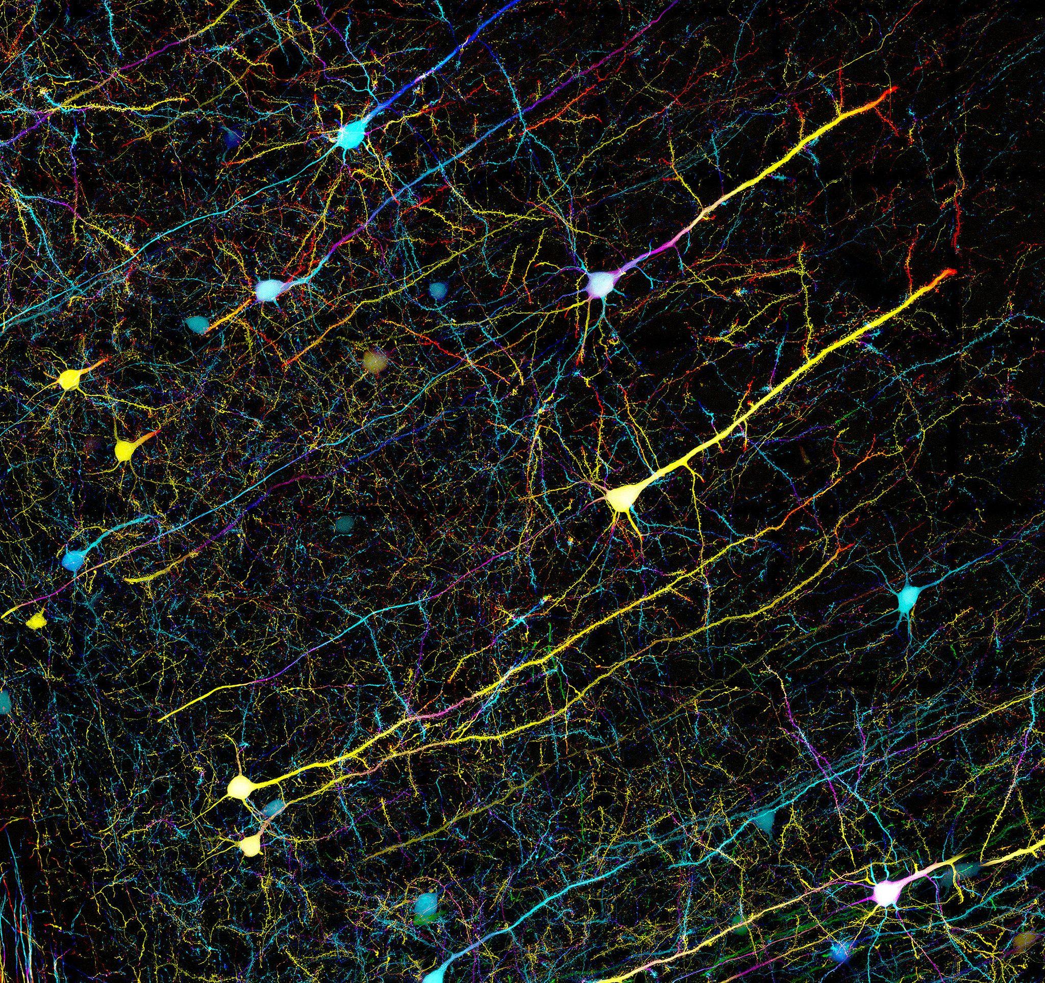 Как нейроны отличают нужные контакты от ненужных