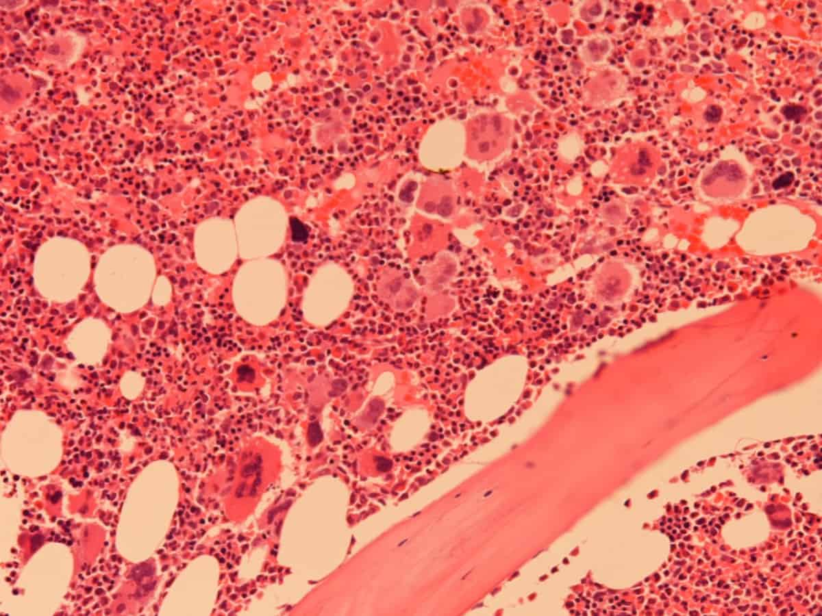 Структуры красного костного мозга. Гистология красный костный мозг кроветворение. Гемопоэтические клетки красного костного мозга гистология. Красный костный мозг гистопрепарат. Bone marrow гистология.
