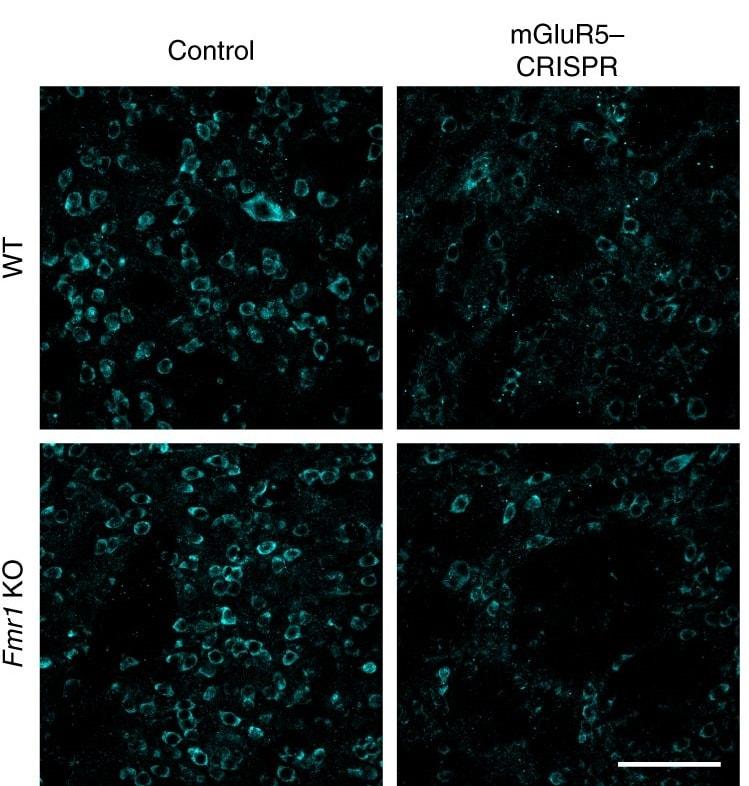 Золотые наночастицы с CRISPR вылечили мышей от аутизма