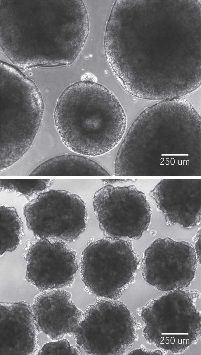 Деформированные органоиды с неандертальской мутацией в ДНК (внизу) Ученые вырастили мини-мозг из клеток с неандертальской мутацией
