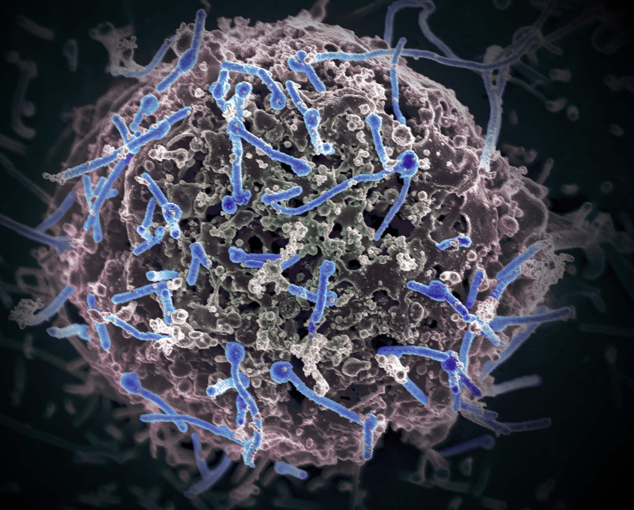Ученые предупредили о возможности появления нового опасного эболавируса