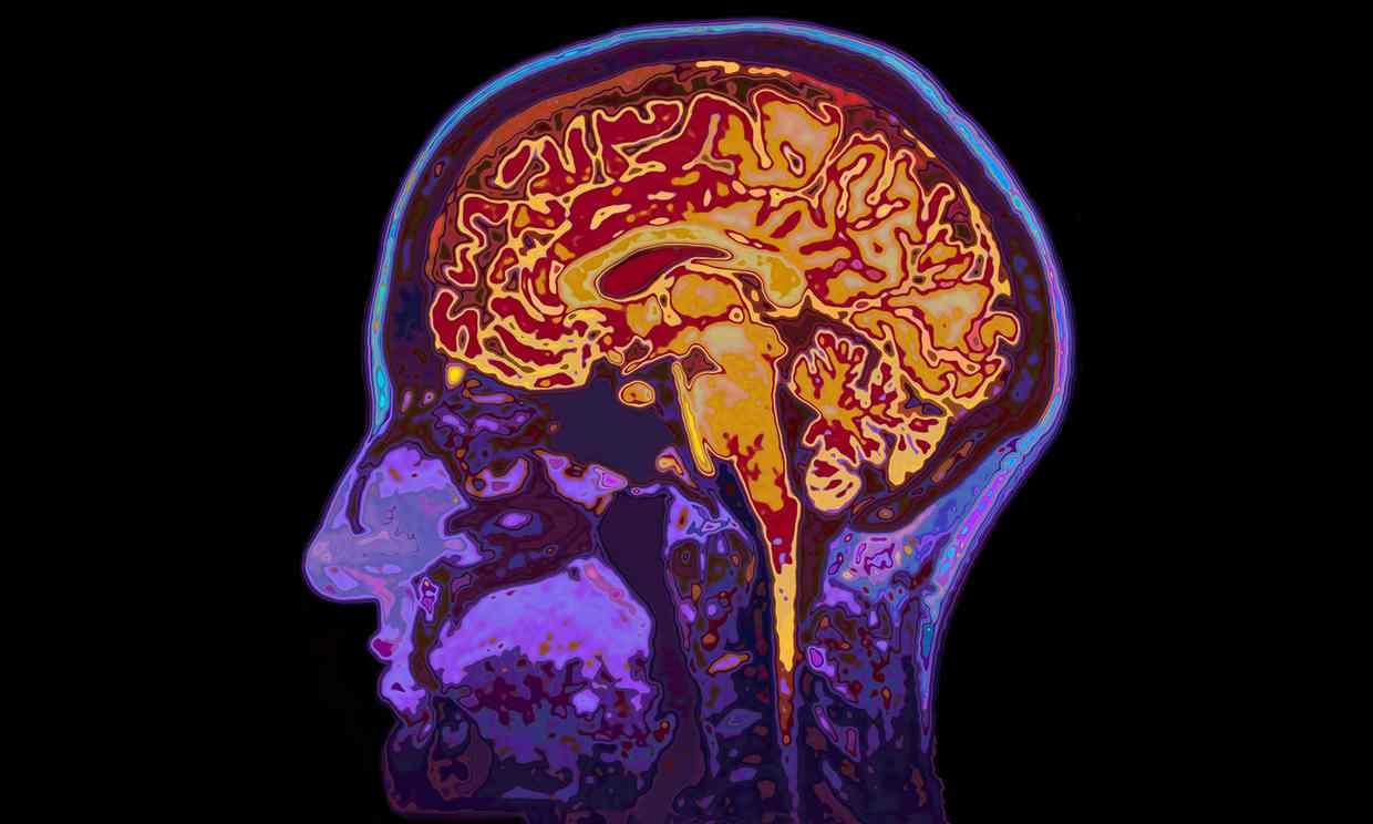 Мозговой имплантат остановил эпилептические припадки у мышей