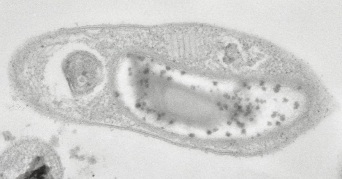 Глубинная сибирская бактерия