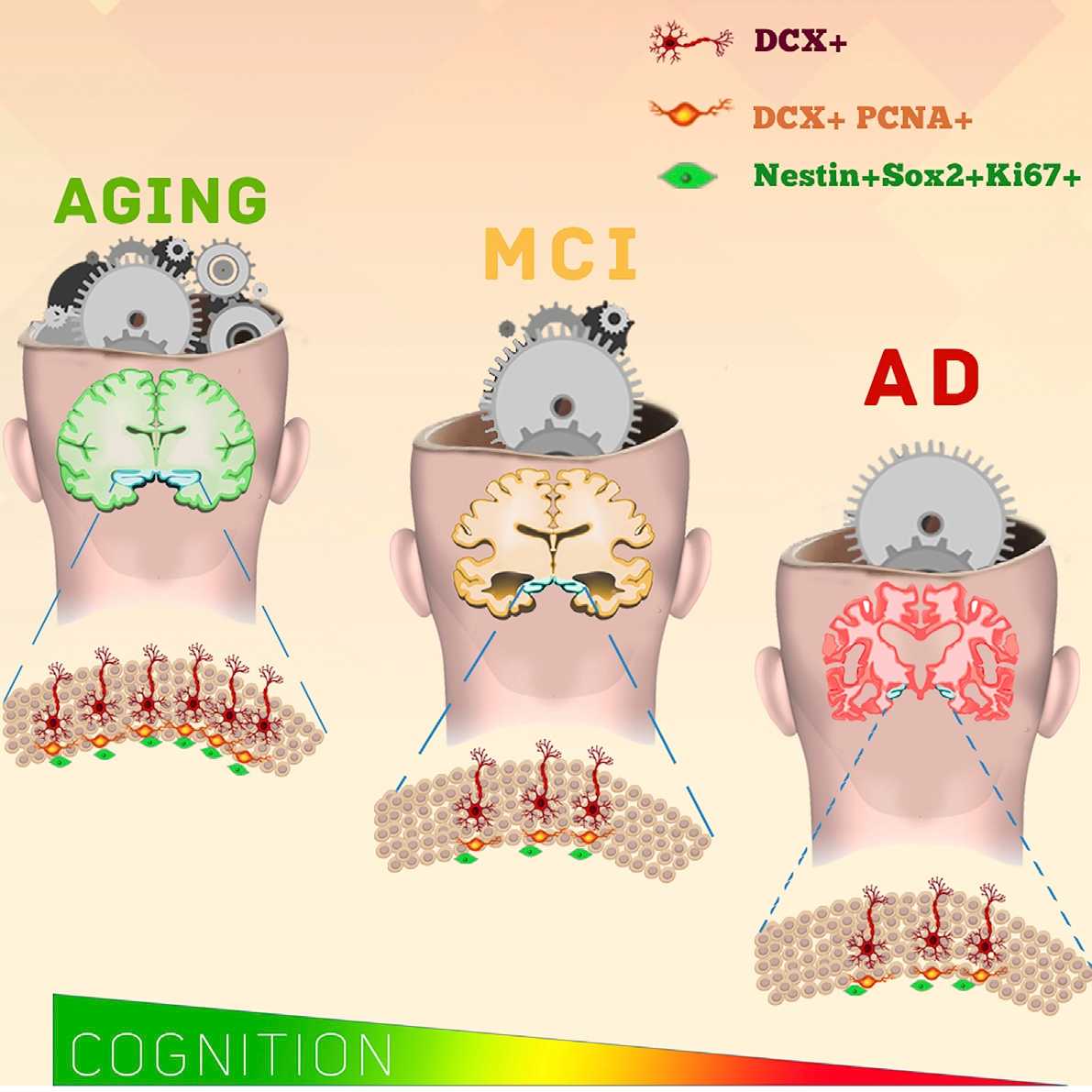 Новые нейроны появляются даже у больных Альцгеймером на десятом десятке жизни Новые нейроны появляются даже у больных Альцгеймером на десятом десятке жизни