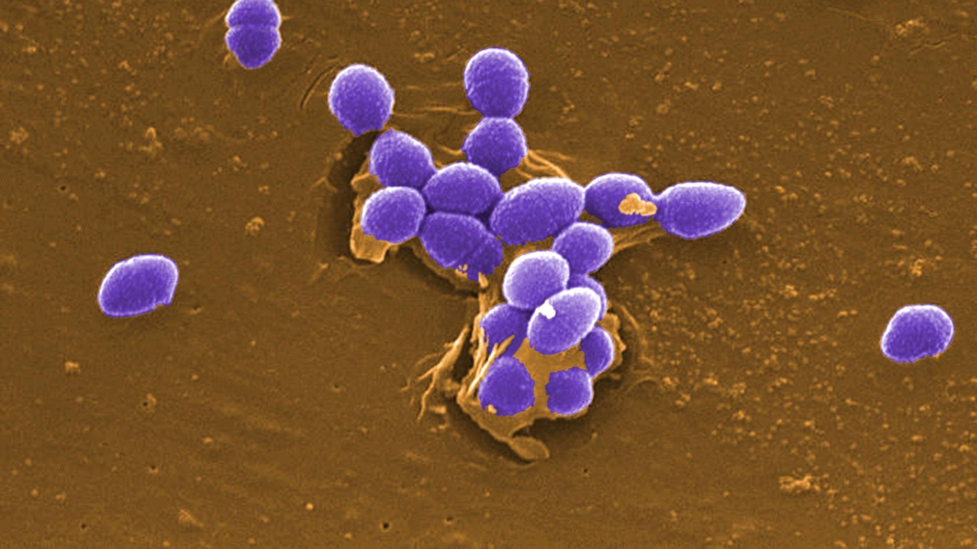 Микробы в кишечнике съедают лекарства