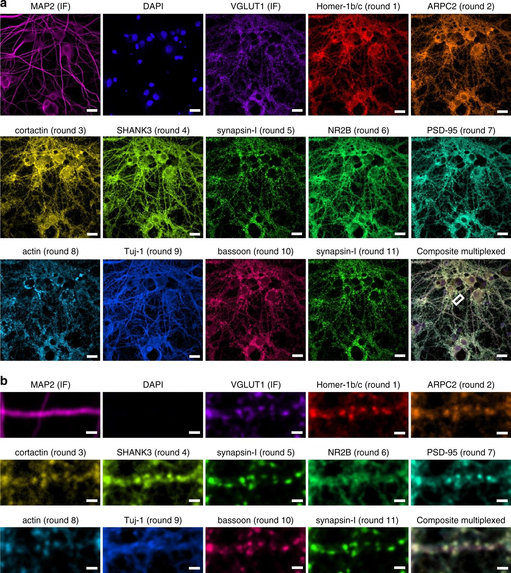 Новая техника нейровизуализации поможет «разглядеть» синапсы по белкам