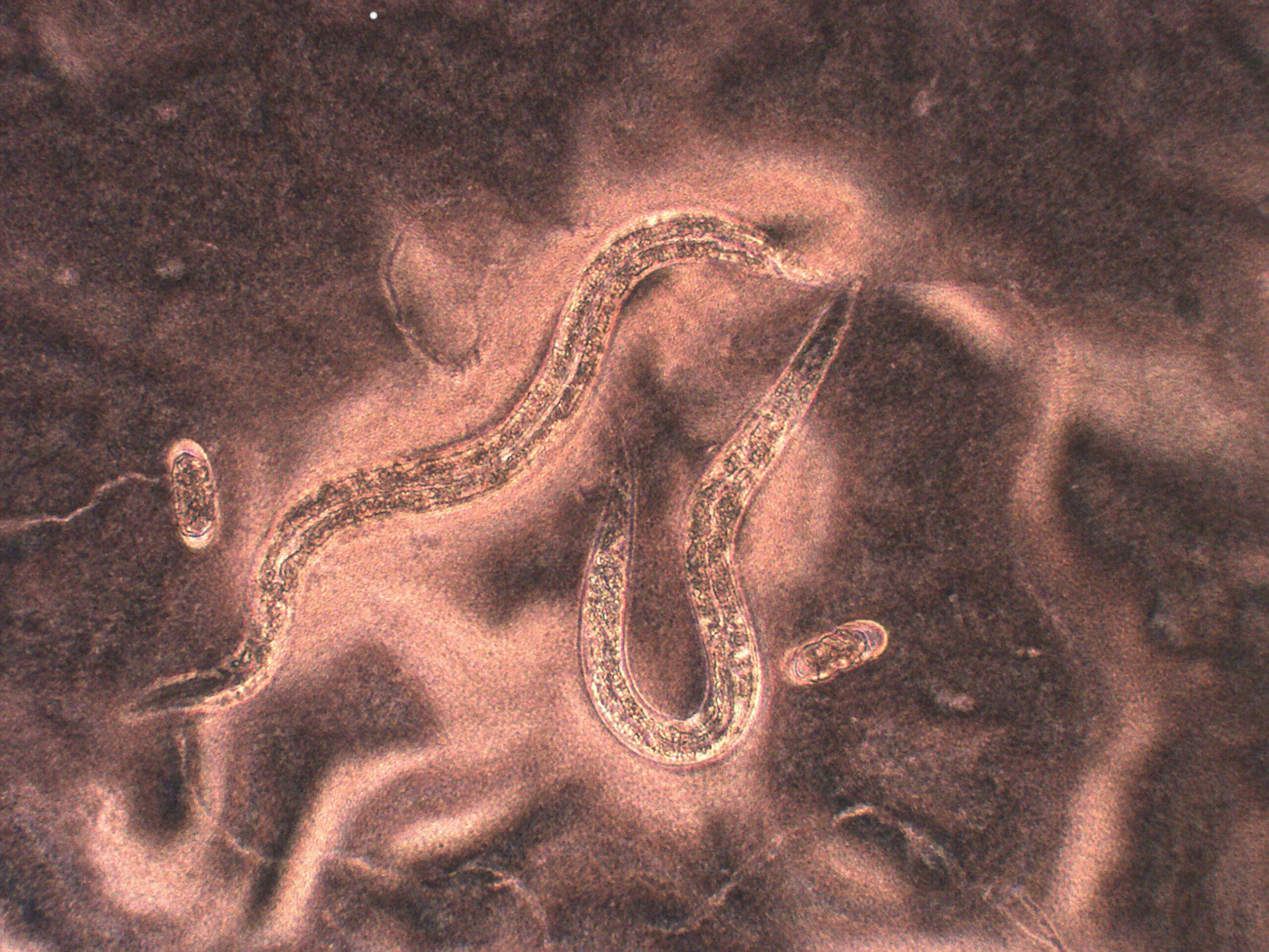 Исследователи секвенировали геном «дьявольского червя»