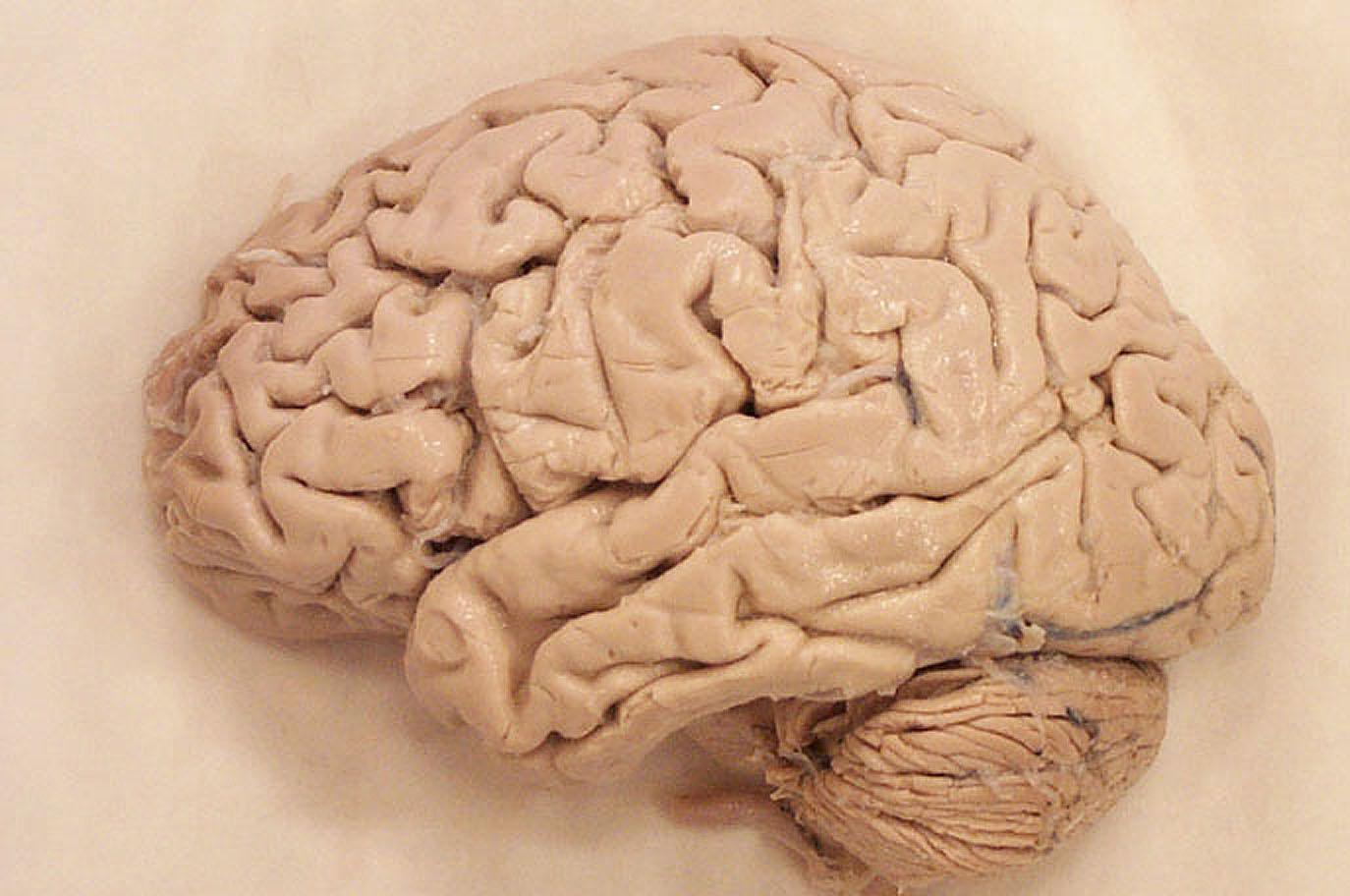 Человеческий мозг. Настоящий человеческий мозг.