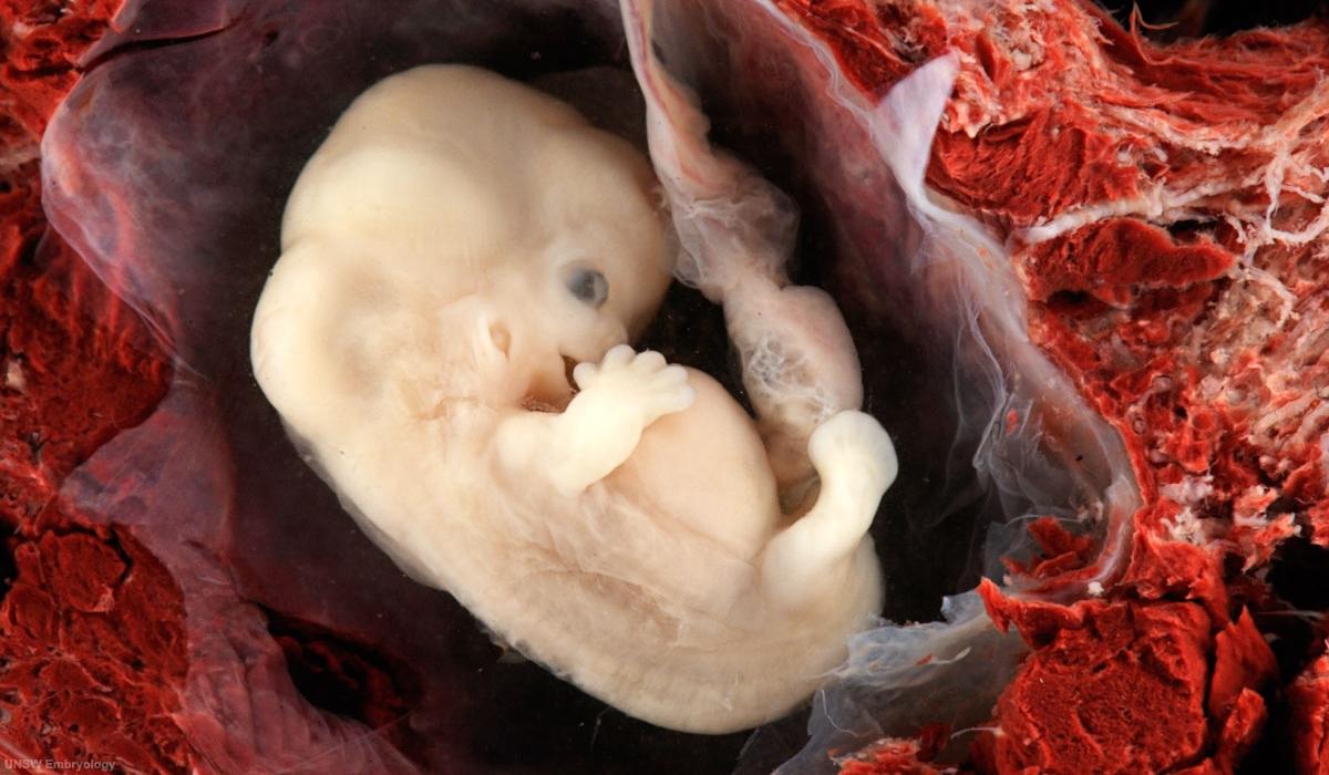 У эмбрионов человека обнаружили признаки старения