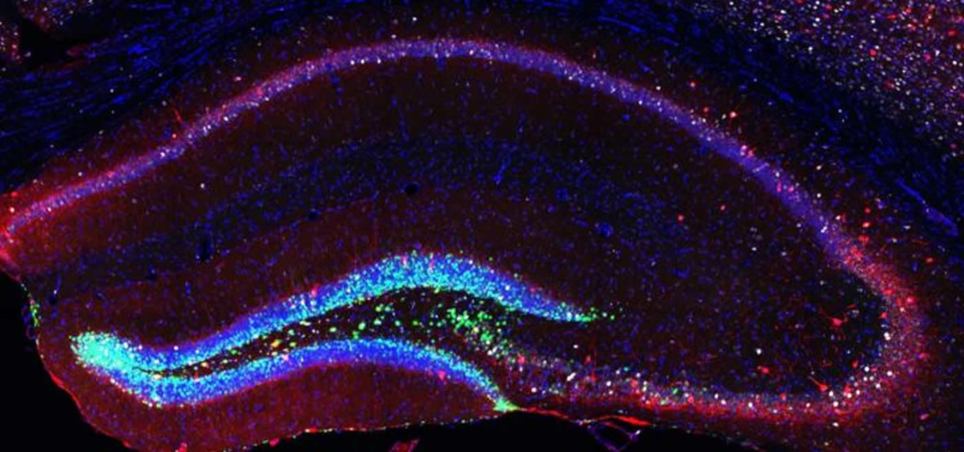 Стимуляция роста новых нейронов сохранит память в преклонном возрасте