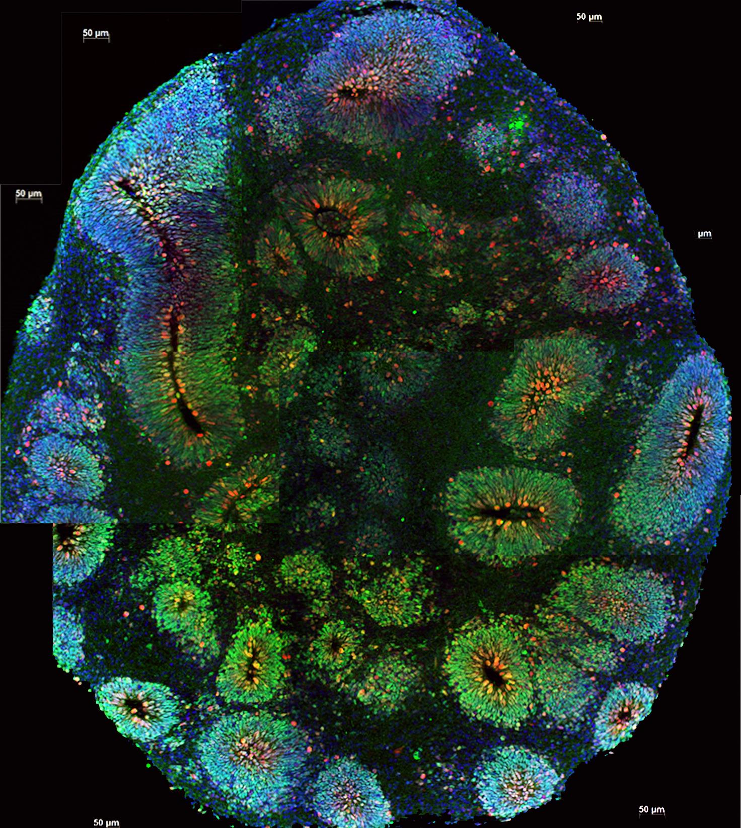 Органоиды мозга как модель для понимания генетики аутизма