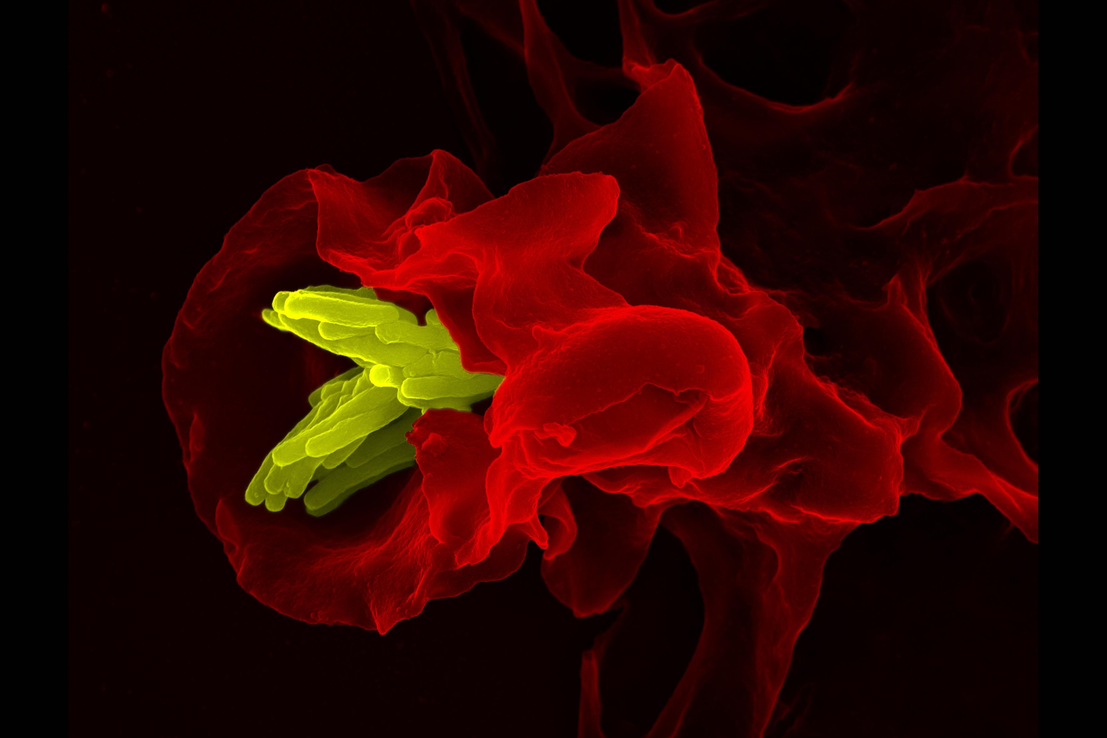 Как иммунные клетки пробираются в плотные ткани