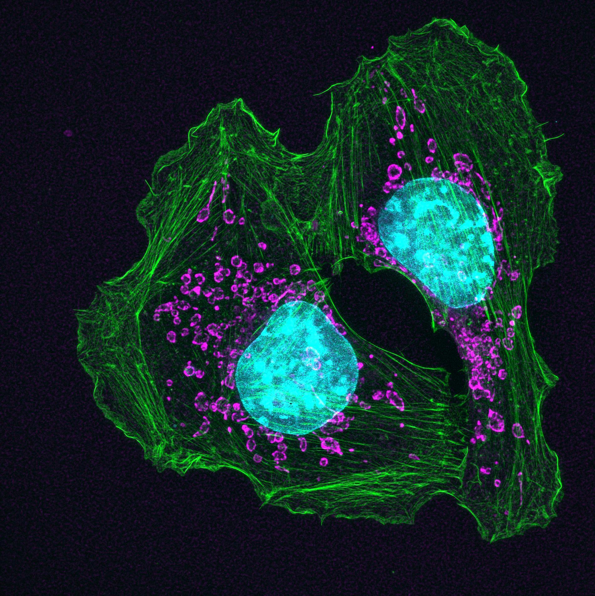 Мутантные клетки не дают друг другу превратиться в опухоль